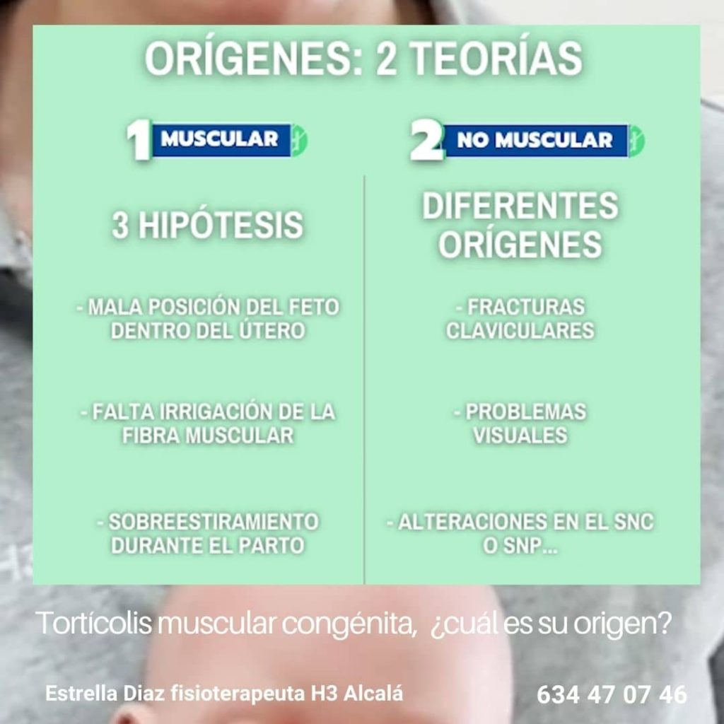 tratamiento de la torticolis muscular en clinicas h3 alcala henares 1024x1024 - Tortícolis muscular congénita Alcalá de Henares